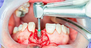 Impianti oggi: quali, da chi e quando?