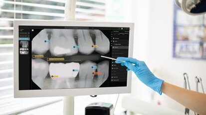 El primer software de AI del mundo que interpreta radiografías dentales