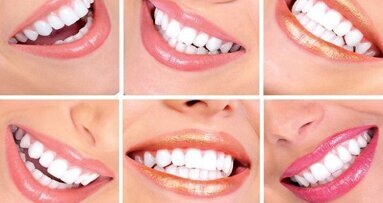 Voorlichting in bleeksalons schiet tekort