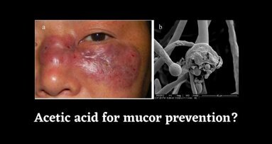 Acetic acid to prevent mucormycosis - Dr. Puneet Wadhwani (OMFS)