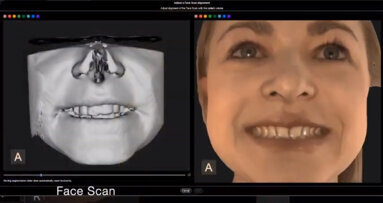 CBCT, Vaše cesta k úspěchu – pokročilý extraorální zobrazovací systém