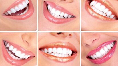 Voorlichting in bleeksalons schiet tekort