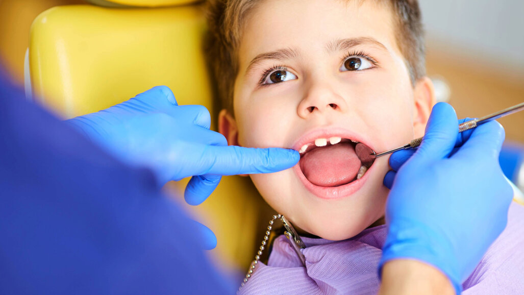Study highlights oral health challenges in children with severe obesity