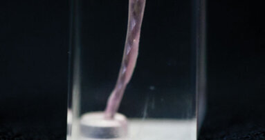 Passive micro-volume management of sodium hypochlorite in endodontic treatment