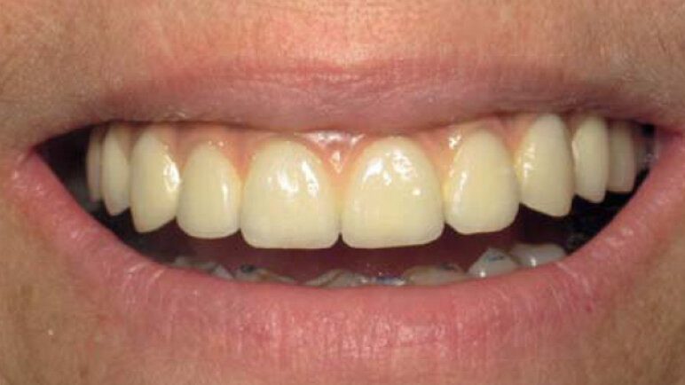 Le High Tech au service de l’implantologie