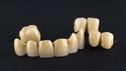 La metallo-ceramica resta la preferita. Lo conferma un’analisi della letteratura