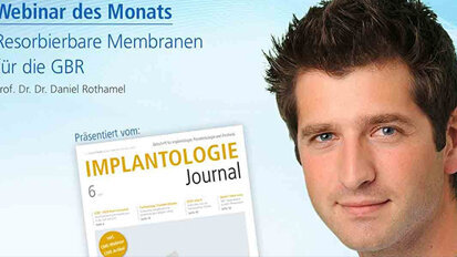 Webinar: Resorbierbare Membranen für die GBR Webinar: Resorbierbare Membranen für die GBR