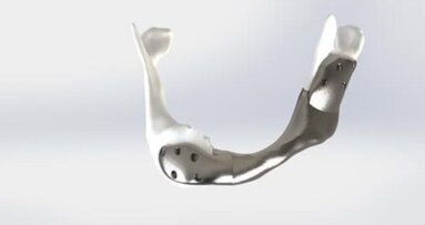 Antoni van Leeuwenhoek plaatst 3D-geprinte onderkaak