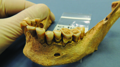 Istraživanje pokazuje kako pomak prema suvremenoj prehrani utječe na oralno zdravlje