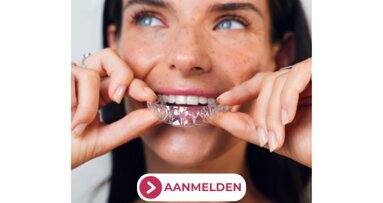 Wilt u starten met Aligners in uw praktijk? Bezoek onze gratis informatieavond!