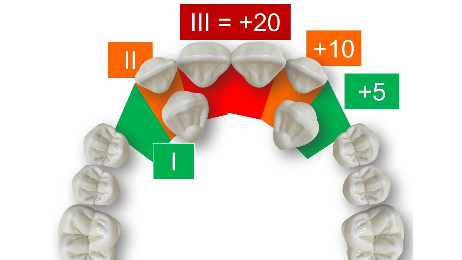 Protocolo para el pronóstico de los caninos superiores retenidos