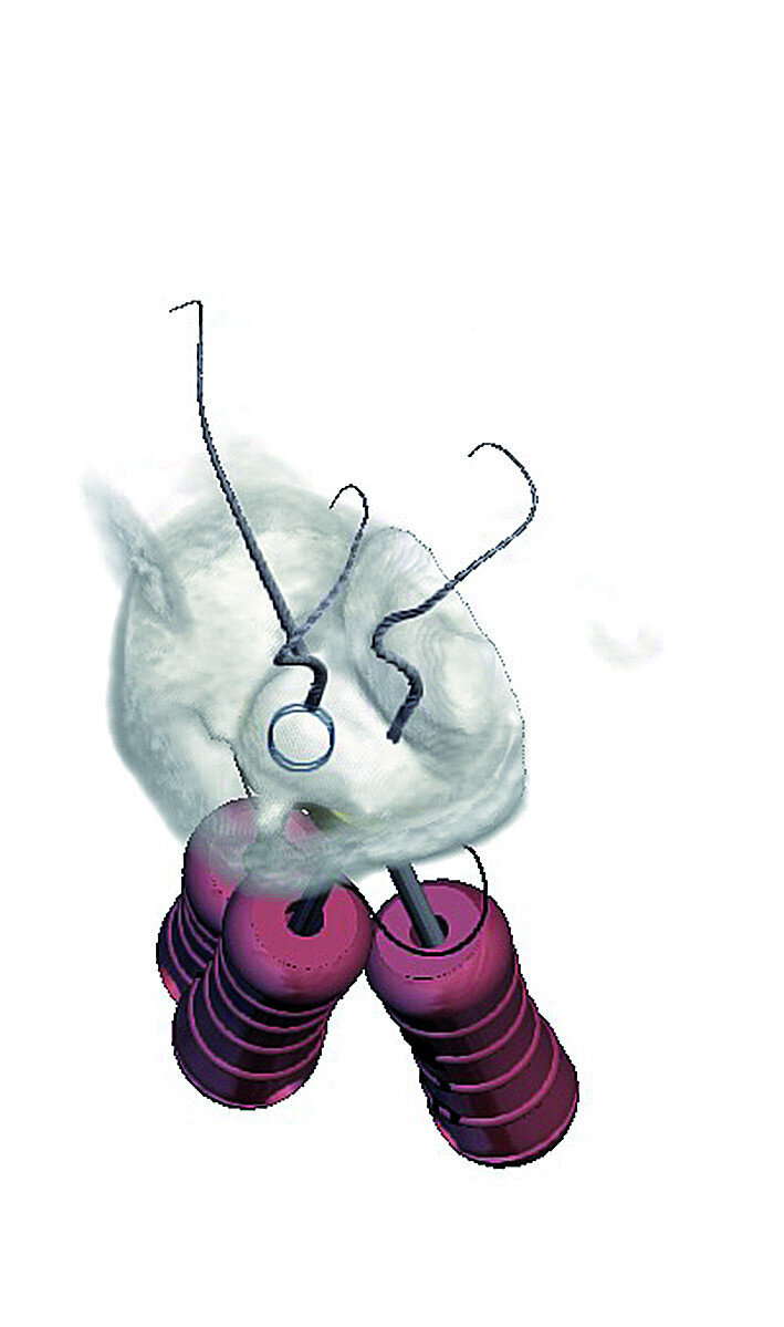 Fig. 12: This software allows the operator to rotate the image in 3-D to alert the operator of the angle and direction of curvatures in the root canal systems. Note the sharp apical curvatures in different planes.