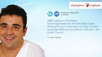 Extraktion und Implantation in einer Sitzung: Experte erklärt Vorteile Extraktion und Implantation in einer Sitzung: Experte erklärt Vorteile