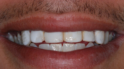 ¡Estética no se escribe con $!