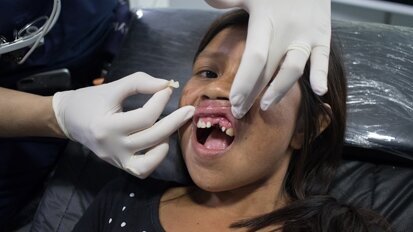 Young patient with missing tooth in position #11. (Photograph: Dentsply Sirona)