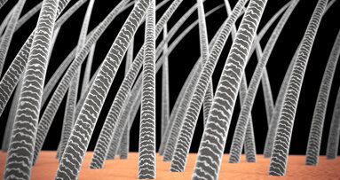 Ricerca: scoperto un legame fra problemi di capelli e carie dentali