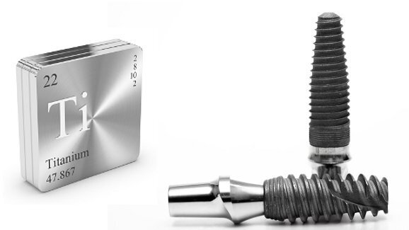 Les implants en titane peuvent comporter un risque de corrosion