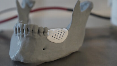 Breakthrough in guided bone regeneration: 3D printing paves the way for advanced scaffolds