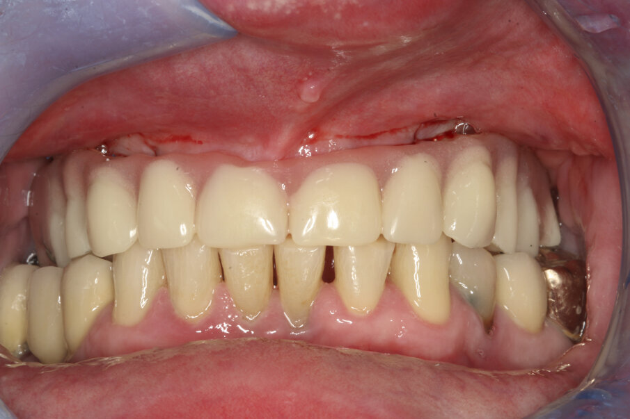 Fig. 14: Design of the Atlantis BridgeBase.