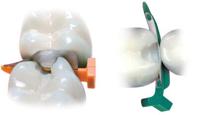 The Fender way: fast and safe The Fender way: fast and safe