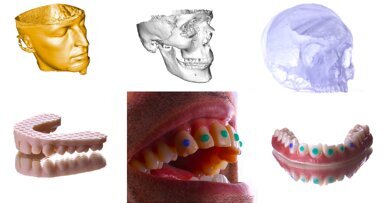 Reconstrucción de una dentadura maya – Newsletter DT Latinoamérica No, 3. 2021