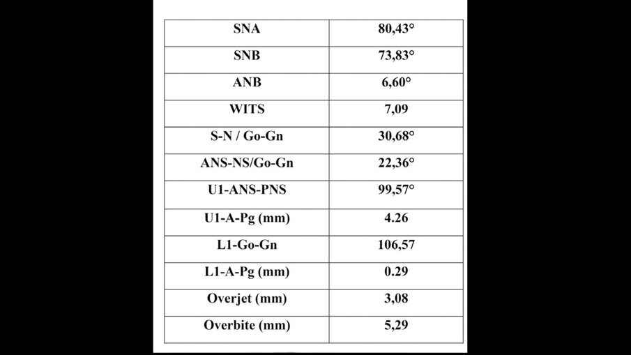Figg. 3a-3c_Acquisizione dei records radiografici. Tracciato cefalometrico iniziale.