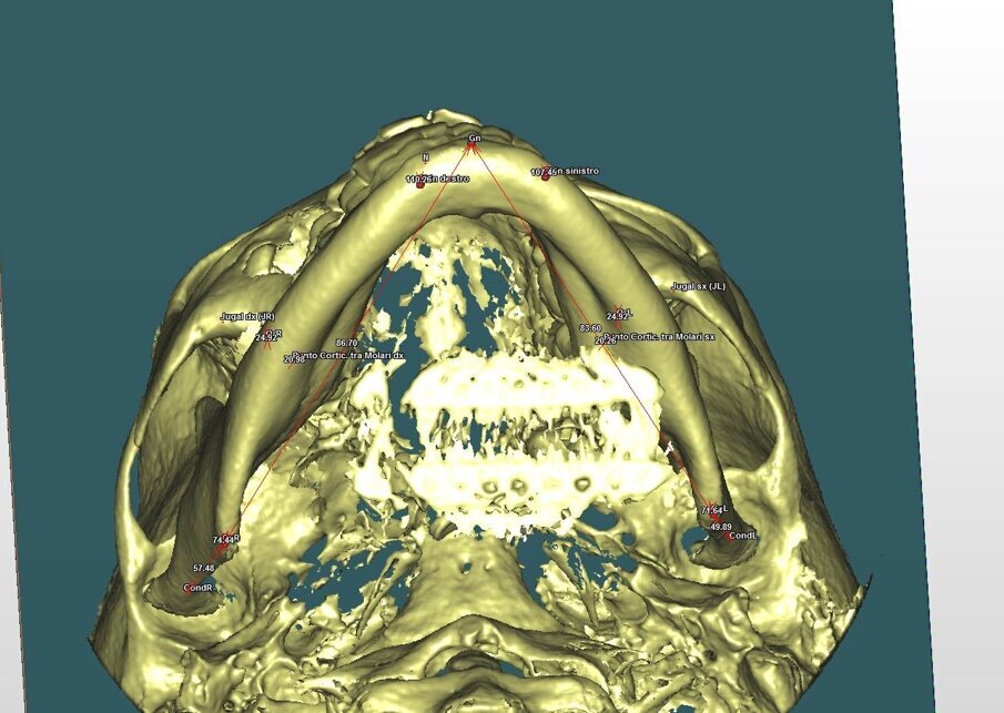 Fig. 2_Visione assiale della cefalometria 3D.