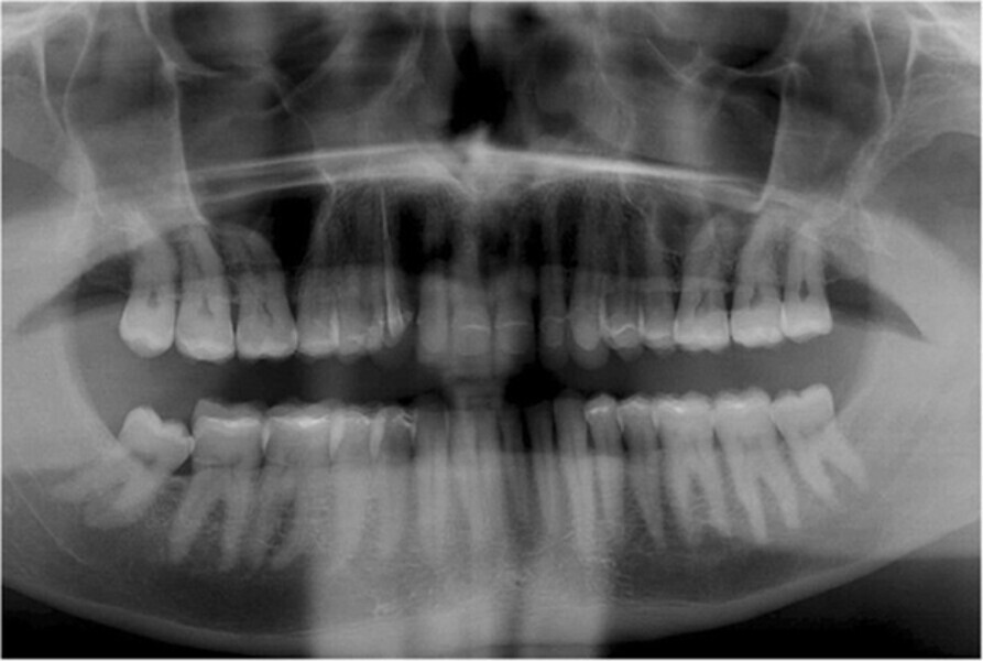 Fig. 15. Imagen panorámica final.