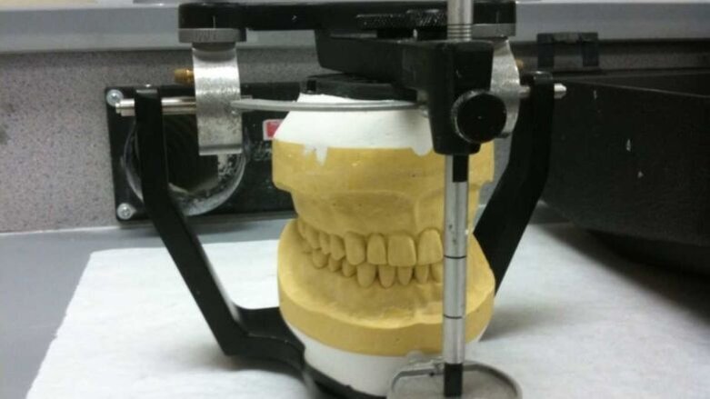 Dr Jayant Palaskar receives US and EU Patents for his invention on Centric Relation (CR) recording