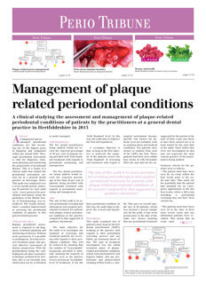 perio-tribune-uk-no-1-2014-0114