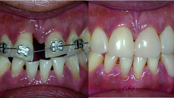 MiCD: Do no harm cosmetic dentistry—Part I