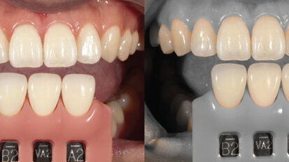 A digital camera designed just for dentists’ clinical photography, case documentation