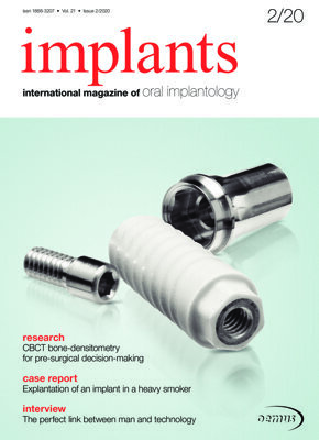 implants international No. 2, 2020 implants international No. 2, 2020
