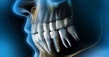 ITI-Kongress 2013 in Salzburg