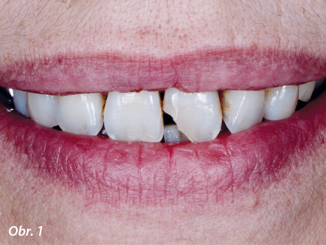 Kazuistika 1 – výchozí stav.