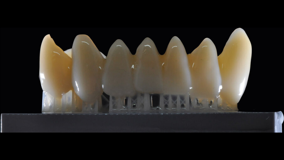 Figg. 4, 5_Restauro stampato con tecnologia TSLA.