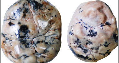 Analysis of ancient fossil teeth provides insight into breastfeeding habits