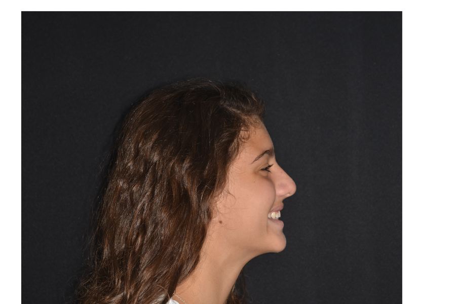 Fig. 2: Facial and intra-oral photographs after treatment with fixed orthodontic appliances.