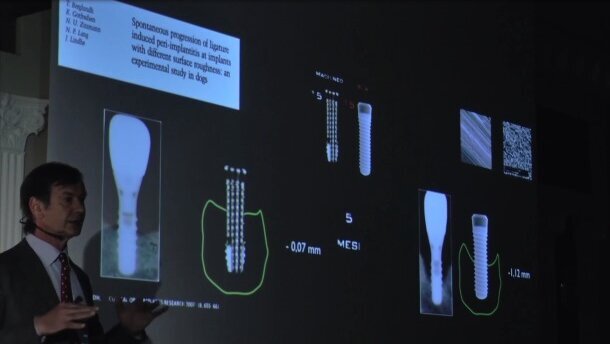 „Kierunki dla implantologii i inżynierii tkankowej” – powierzchnia implantów