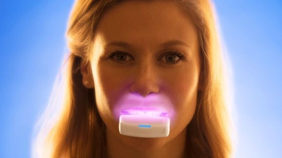 Интраоралната фотобиомодулация може да намали времето за ортодонтско лечение