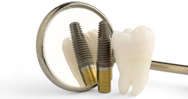 Seminar zu Periimplantitis