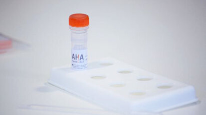 “Tijdige diagnose mondkanker redt levens”