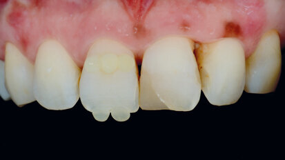 Jednoduchá souhra odstínů k vytvoření opticky harmonické výplně