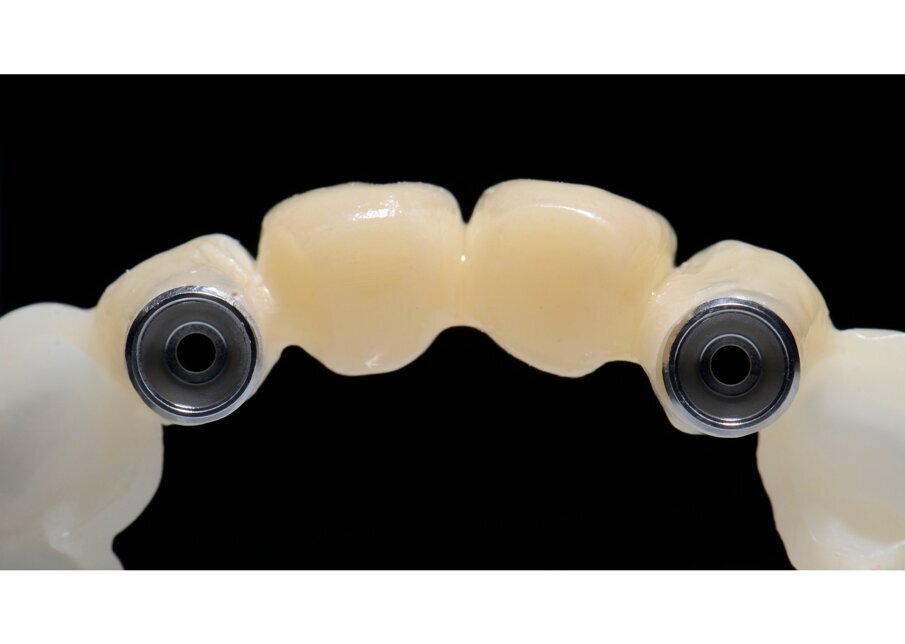 g. 55 - Provvisorio finalizzato. 