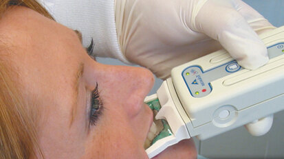 Control excess occlusal forces on implants