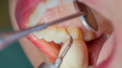 Implants should only be inserted when periodontal conditions are stable