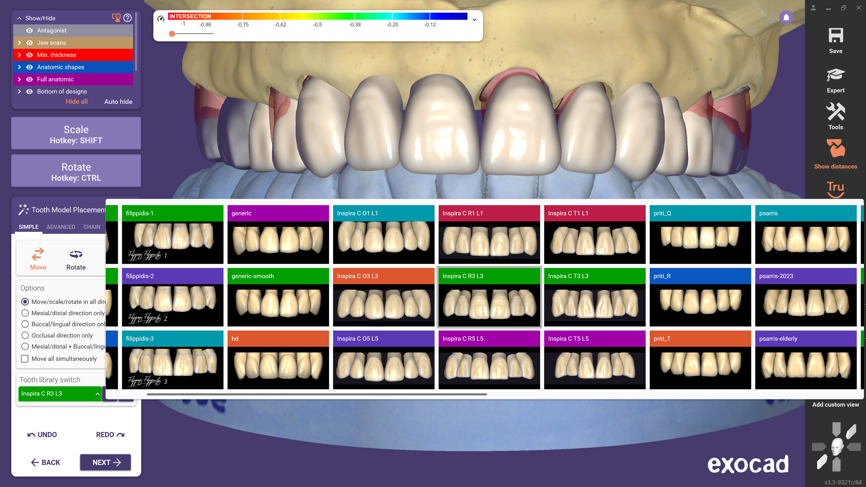 Newly added Inspira tooth shapes for crown and bridge applications.