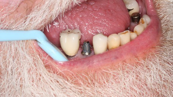 士卓曼购得美RODO Medical公司12%的股份