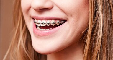 Beugelende tandarts wordt ‘tandarts voor orthodontie’