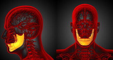 Craniofacial surgery: Customized bone implants grown inside the patient